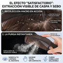 Cepillo Masajeador Anticaspa – Exfolia el Cuero Cabelludo y Elimina Residuos
