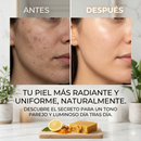 Jabón Artesanal de Cúrcuma – Aclara la piel de Forma Natural